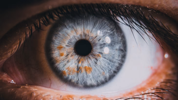 Warum sehe ich Wellenlinien auf meinem Bild?