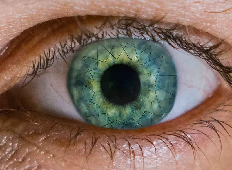 Was sind die Ursachen für Wellen in den Augen?