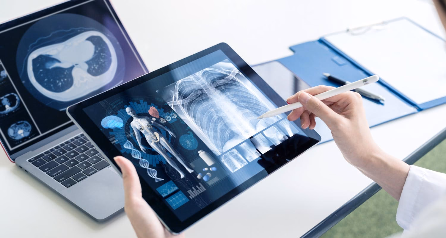 Was kostet ein digitales Röntgenbild?