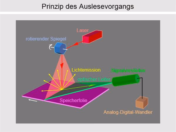 Was kostet ein digitales Röntgenbild?