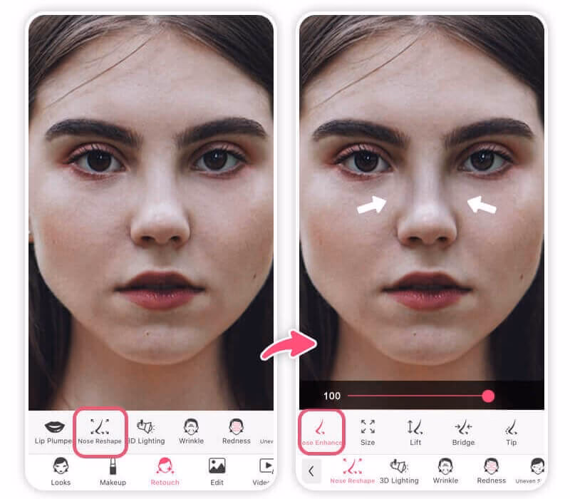 Wie mache ich meine Nase gerade?