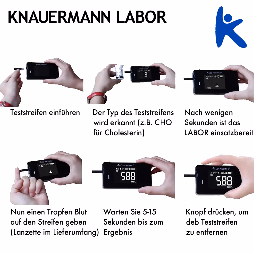 Was taugen Blutzucker Smartwatch?