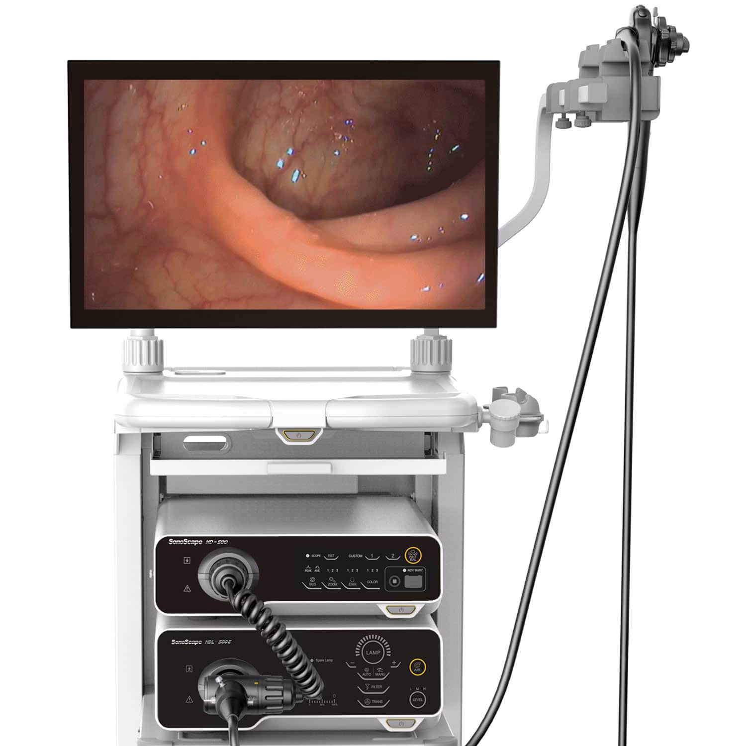Wo wird das Endoskop eingeführt?