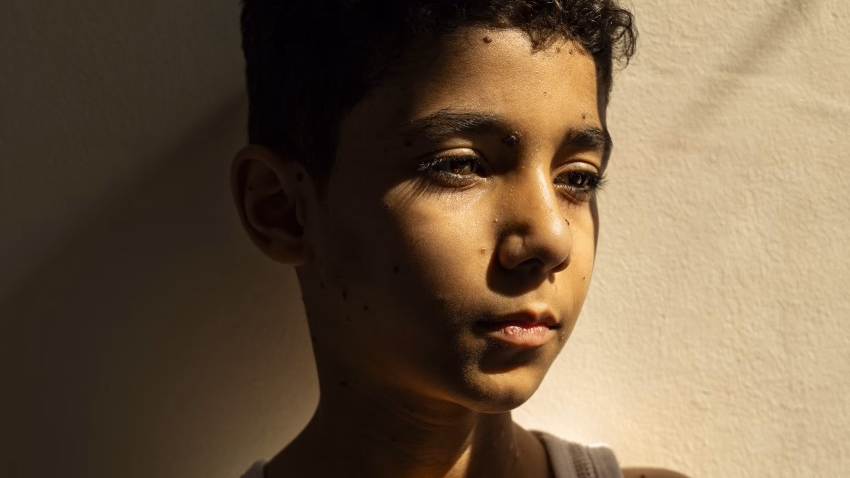 Did Bartholomew win the World Press Photo of the Year in 1984?