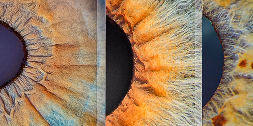 Welche Kamera für Iris-Fotografie?