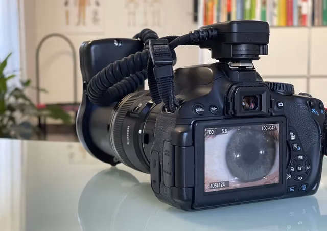 Was kostet eine Irisdiagnostik?