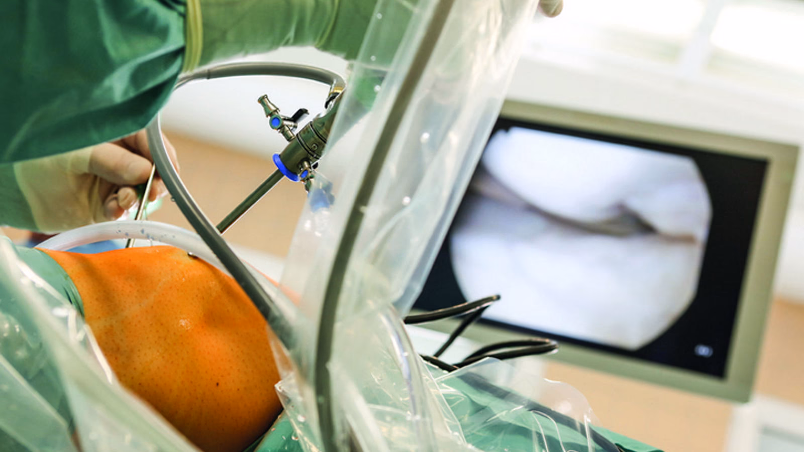 Warum tut eine arthroskopische Knieoperation so weh?