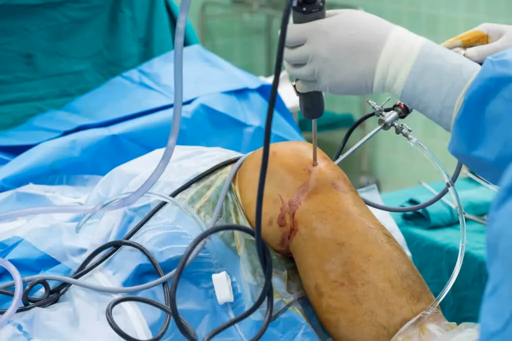 Wie wird das Knie mit einer Kamera untersucht?