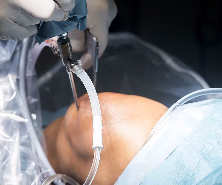 Wie wird das Knie mit einer Kamera untersucht?