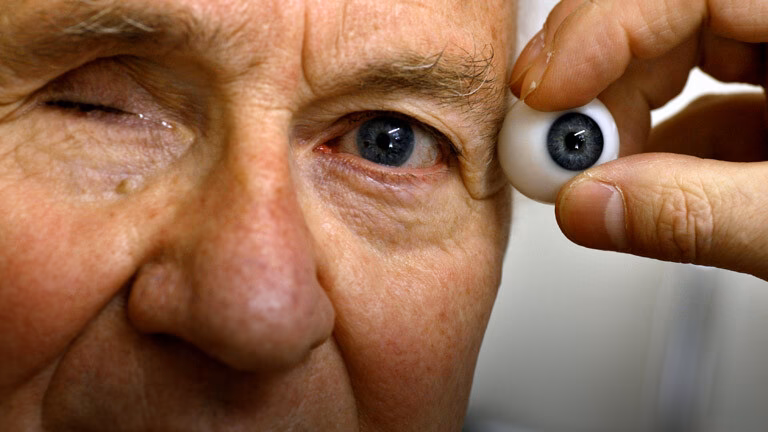 Was kostet ein künstliches Auge?