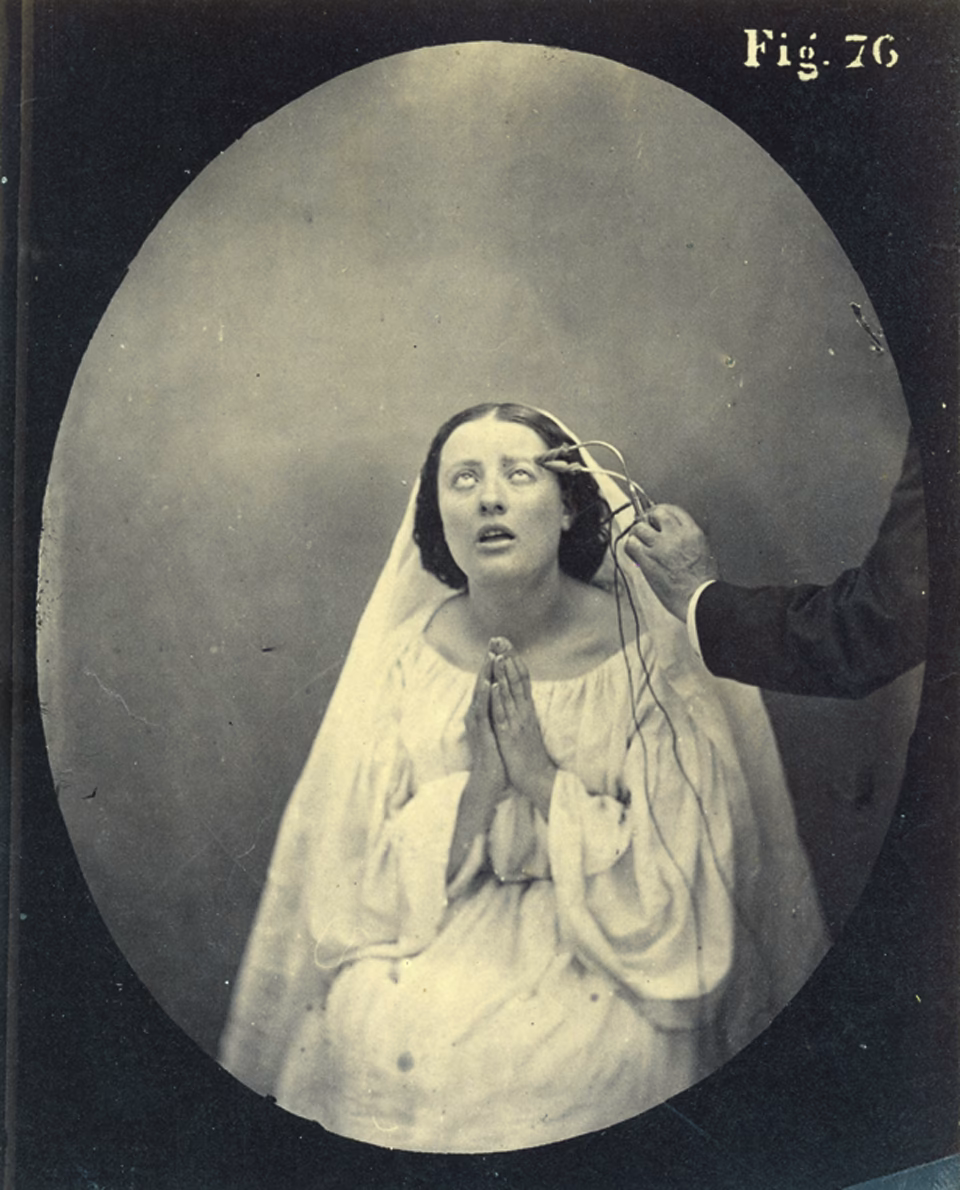 Warum heißt es post mortem?