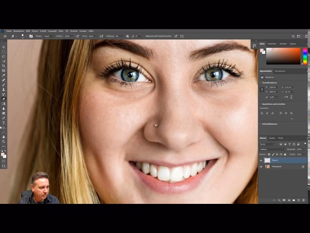 Wie kann man rote Backen entfernen?
